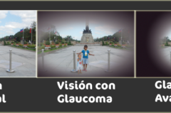 Día mundial del glaucoma