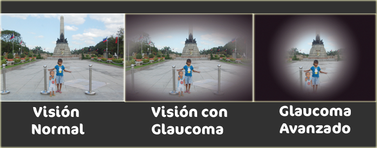 Visión normal y con glaucoma